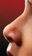 Hemorragias nasales